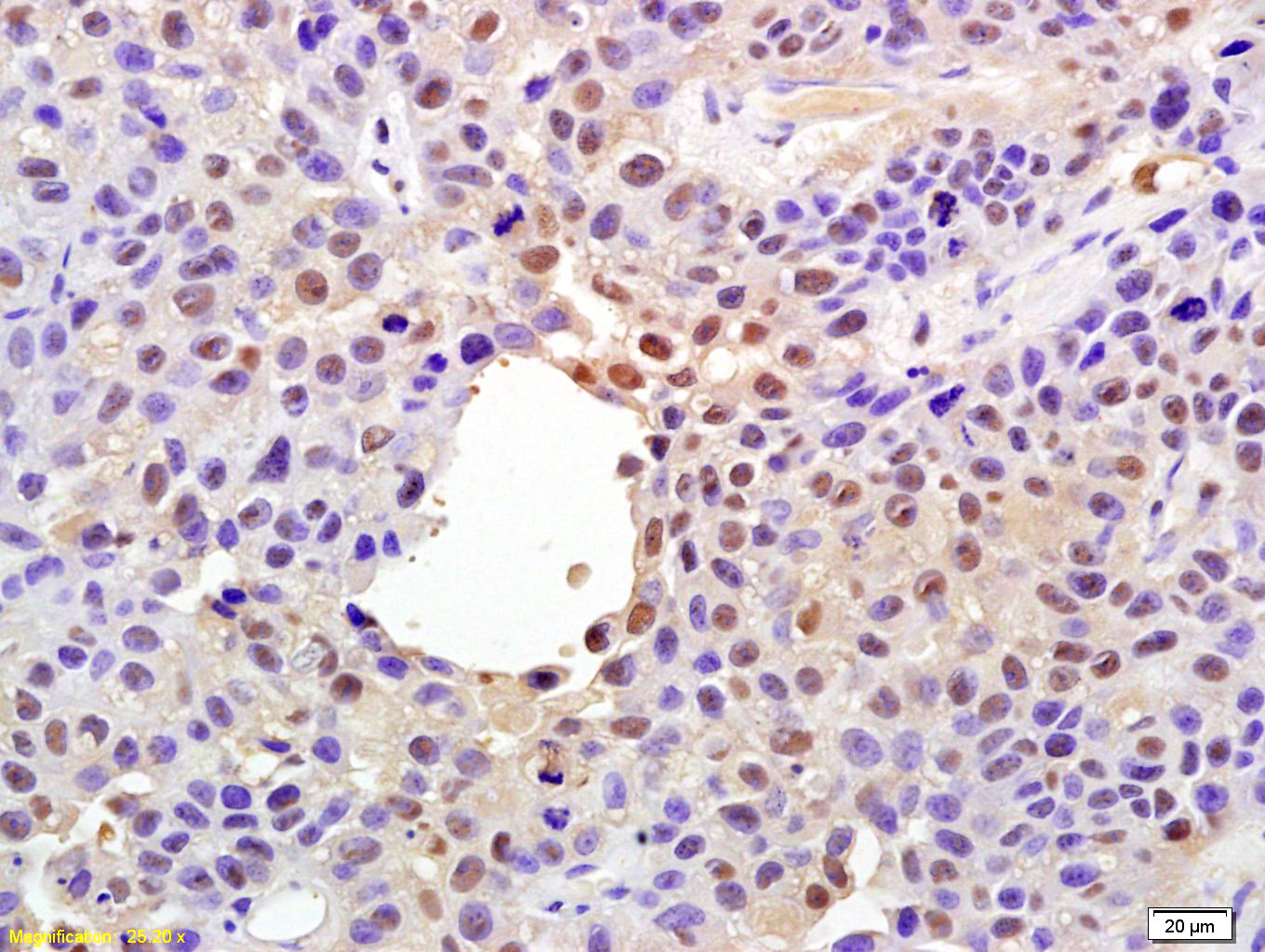 phospho-YAP1 (Ser127) Rabbit pAb (一抗) | Bioss