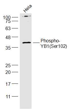 phospho-YB1 (Ser102) Rabbit pAb (一抗) | Bioss