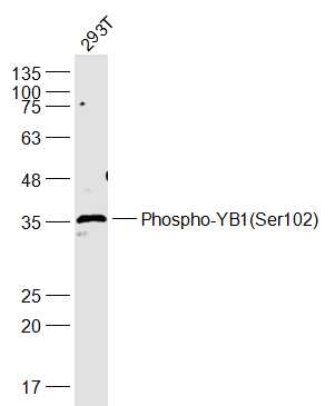磷酸化核酸酶敏感元件结合蛋白1抗体-bs-3477R