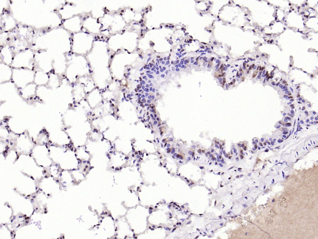 磷酸化核酸酶敏感元件结合蛋白1抗体-bs-3477R