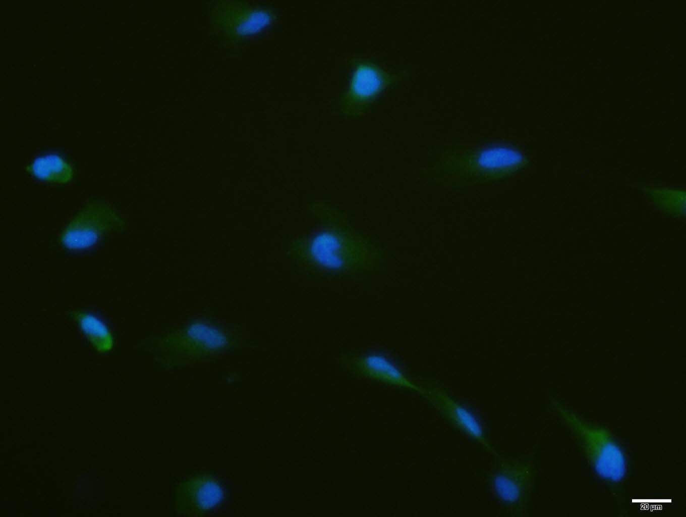 磷酸化核酸酶敏感元件结合蛋白1抗体-bs-3477R