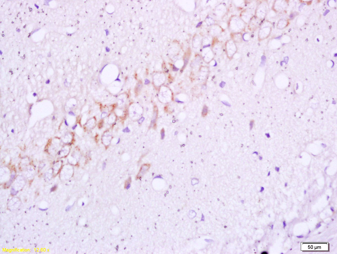 磷酸化胰岛素受体β抗体-bs-3492R