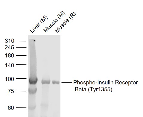 phospho-Insulin Receptor Beta (Tyr1355) Rabbit pAb (一抗) - WB,IHC-P,IHC-F,IF,Flow-Cyt | Bioss