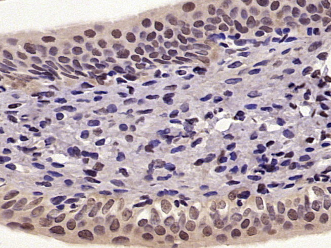 磷酸化细胞核因子NF-κB p65抗体-bs-3543R