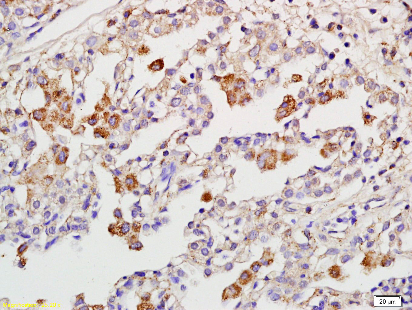 受体结合丝氨酸苏氨酸激酶3抗体-bs-3551R