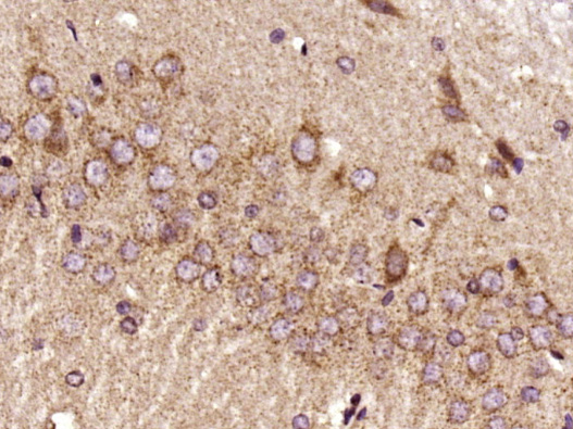 受体结合丝氨酸苏氨酸激酶3抗体-bs-3551R