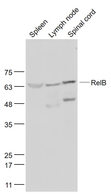 核转录因子NFKB-RelB蛋白抗体-bs-3562R