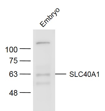SLC40A1 Rabbit pAb (一抗) | Bioss