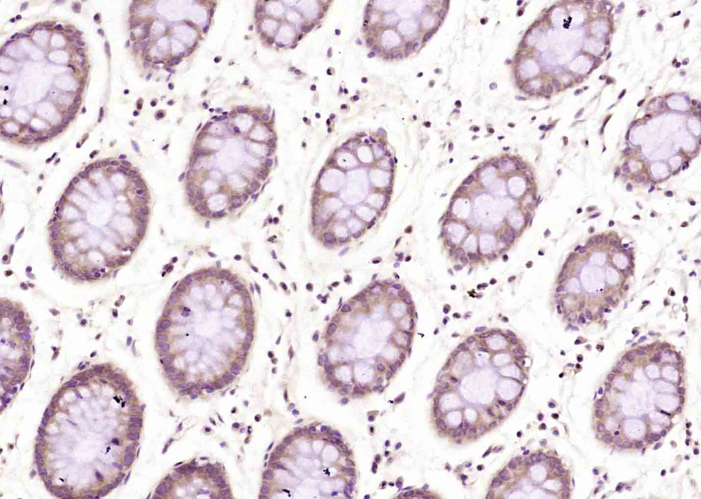 转录中介因子Tif1α抗体-bs-3580R