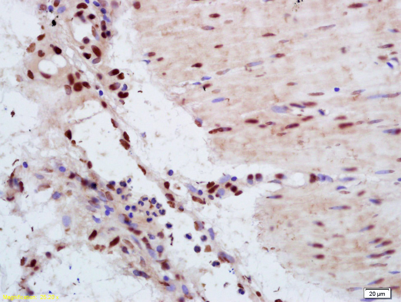YAP1 Rabbit pAb (一抗) - IHC-P,IHC-F,IF,ICC/IF | Bioss