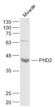 PHD2 Rabbit pAb (一抗) - WB,IHC-P,IHC-F,IF,ICC/IF | Bioss