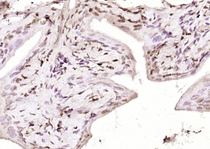磷酸化细胞肿瘤抗原P53抗体-bs-3705R
