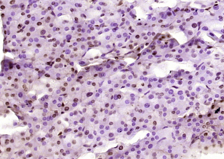 磷酸化细胞肿瘤抗原P53抗体-bs-3705R