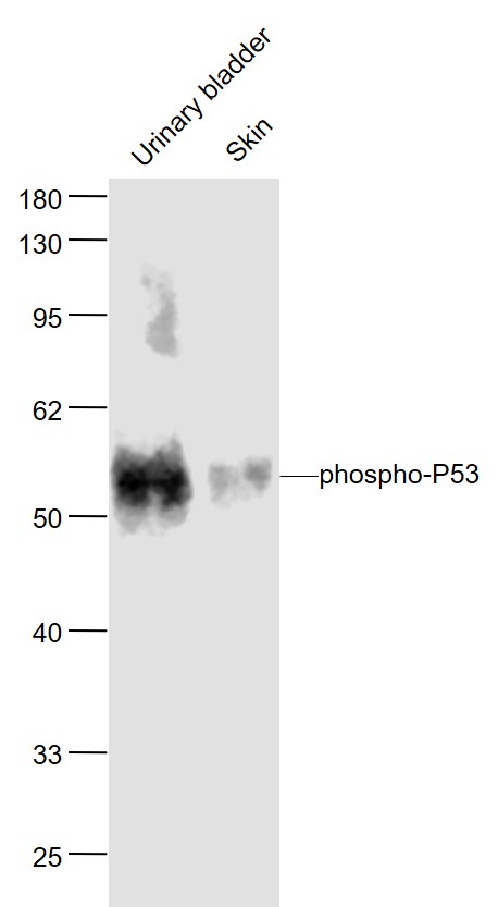 磷酸化细胞肿瘤抗原P53抗体-bs-3705R