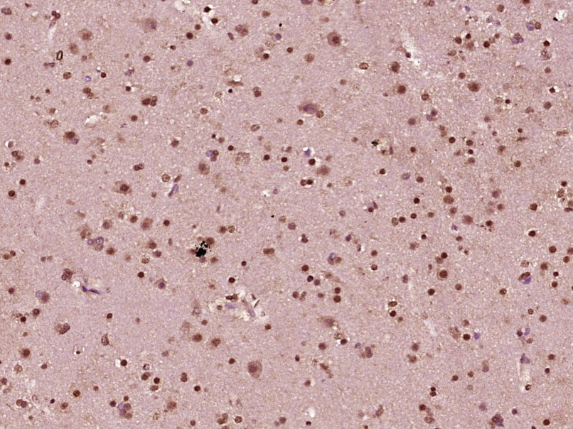 热休克因子1抗体-bs-3757R