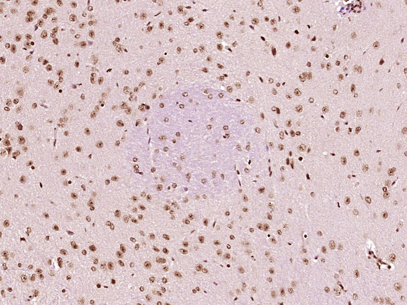 热休克因子1抗体-bs-3757R