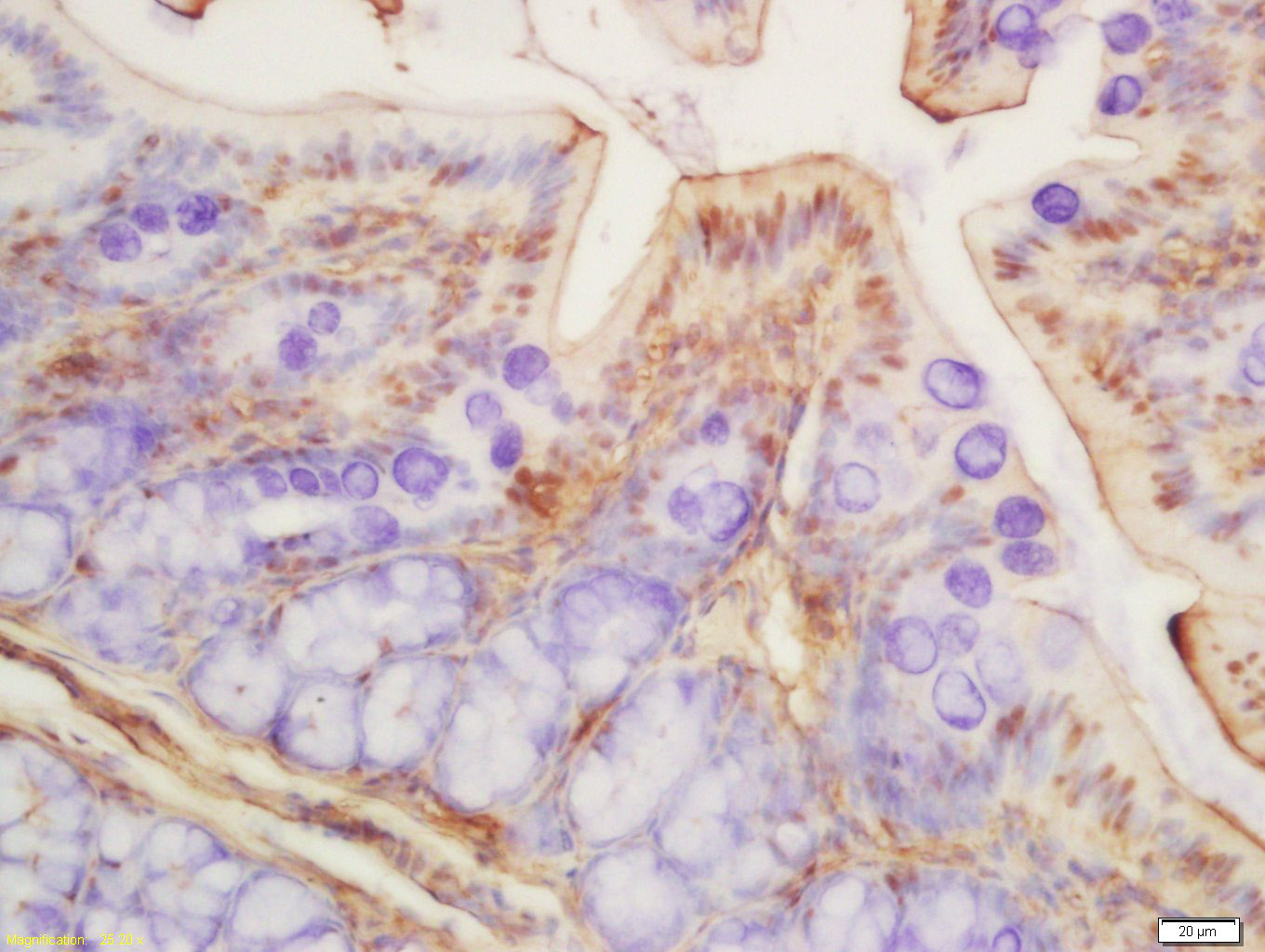 乙酰化组蛋白H3抗体-bs-3776R