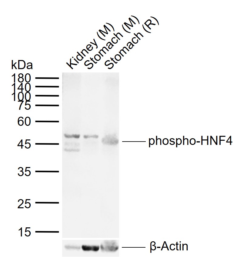 phospho-HNF4 (Ser313) Rabbit pAb (一抗) | Bioss