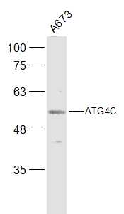 自噬相关蛋白4C抗体-bs-4008R