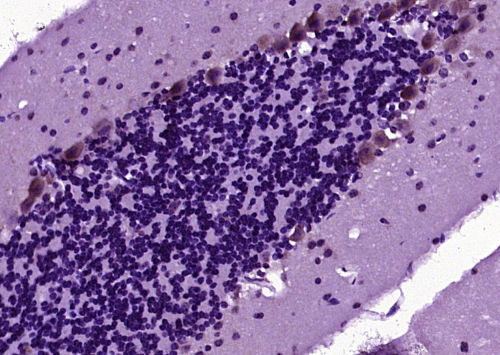 磷酸化微管相关蛋白抗体-bs-4049R