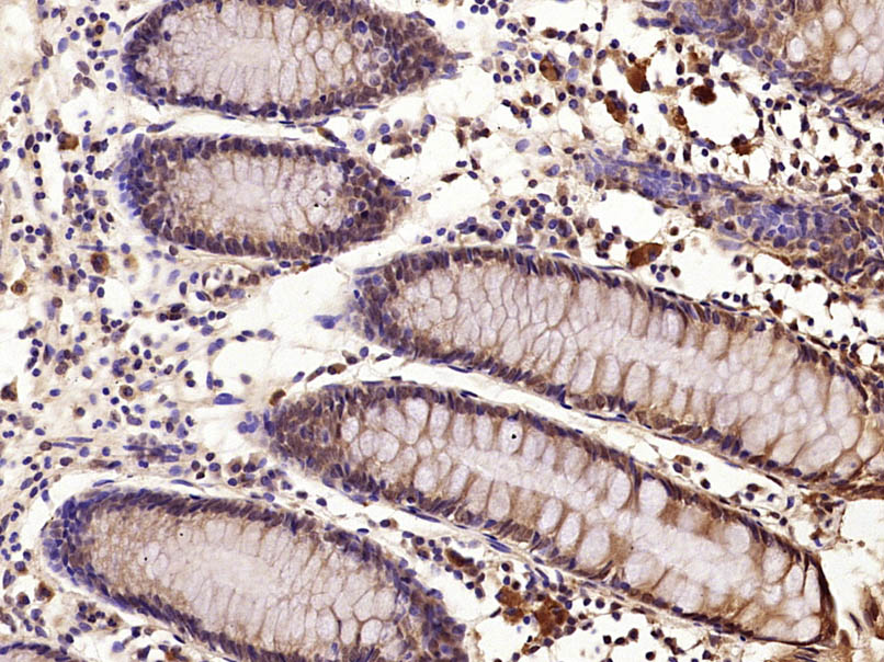 磷酸化转录因子E2F-1抗体-bs-4076R