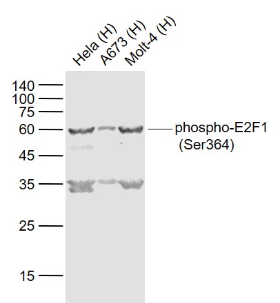 phospho-E2F1 (Ser364) Rabbit pAb (一抗) | Bioss