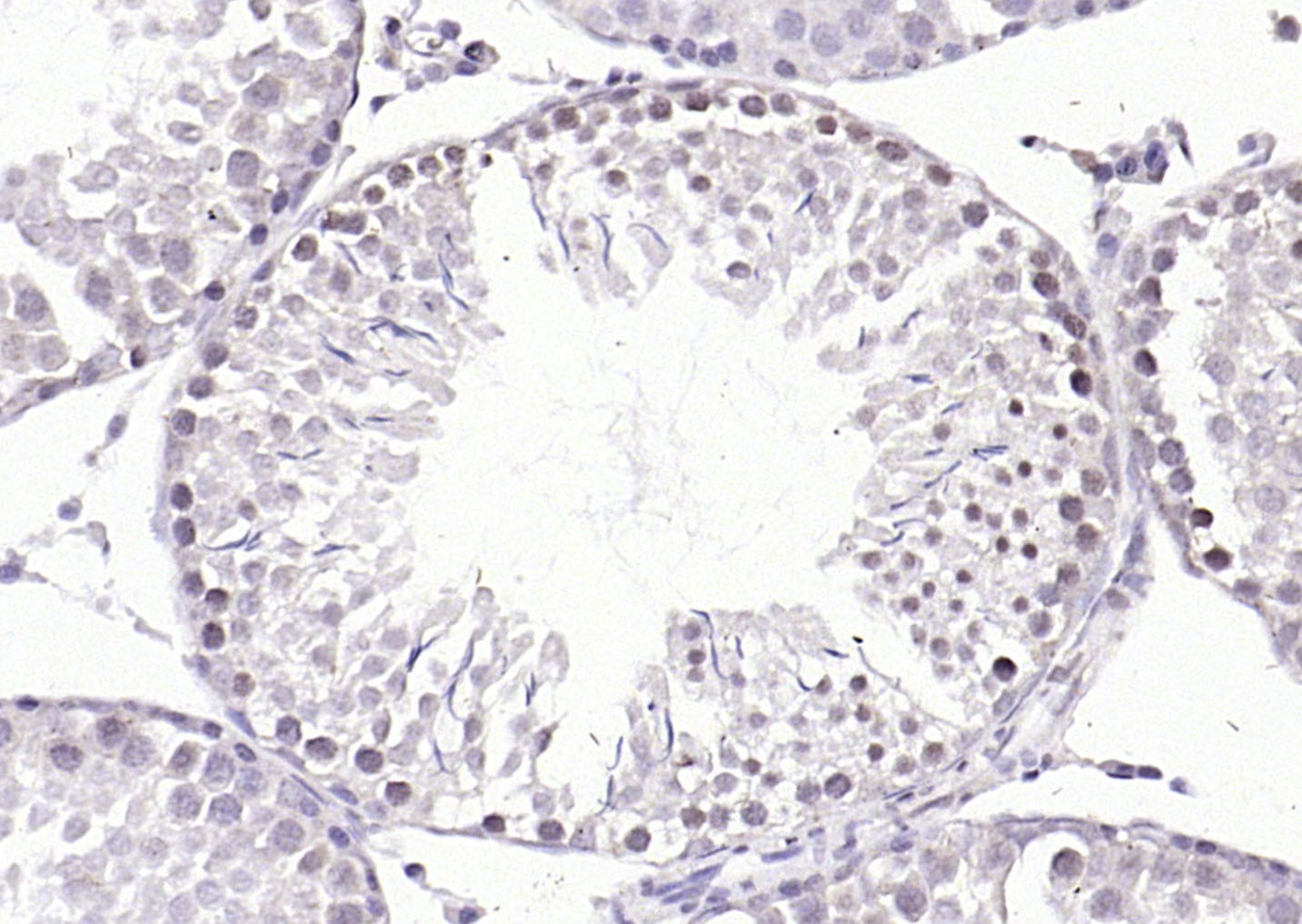 磷酸化转录因子E2F-1抗体-bs-4076R