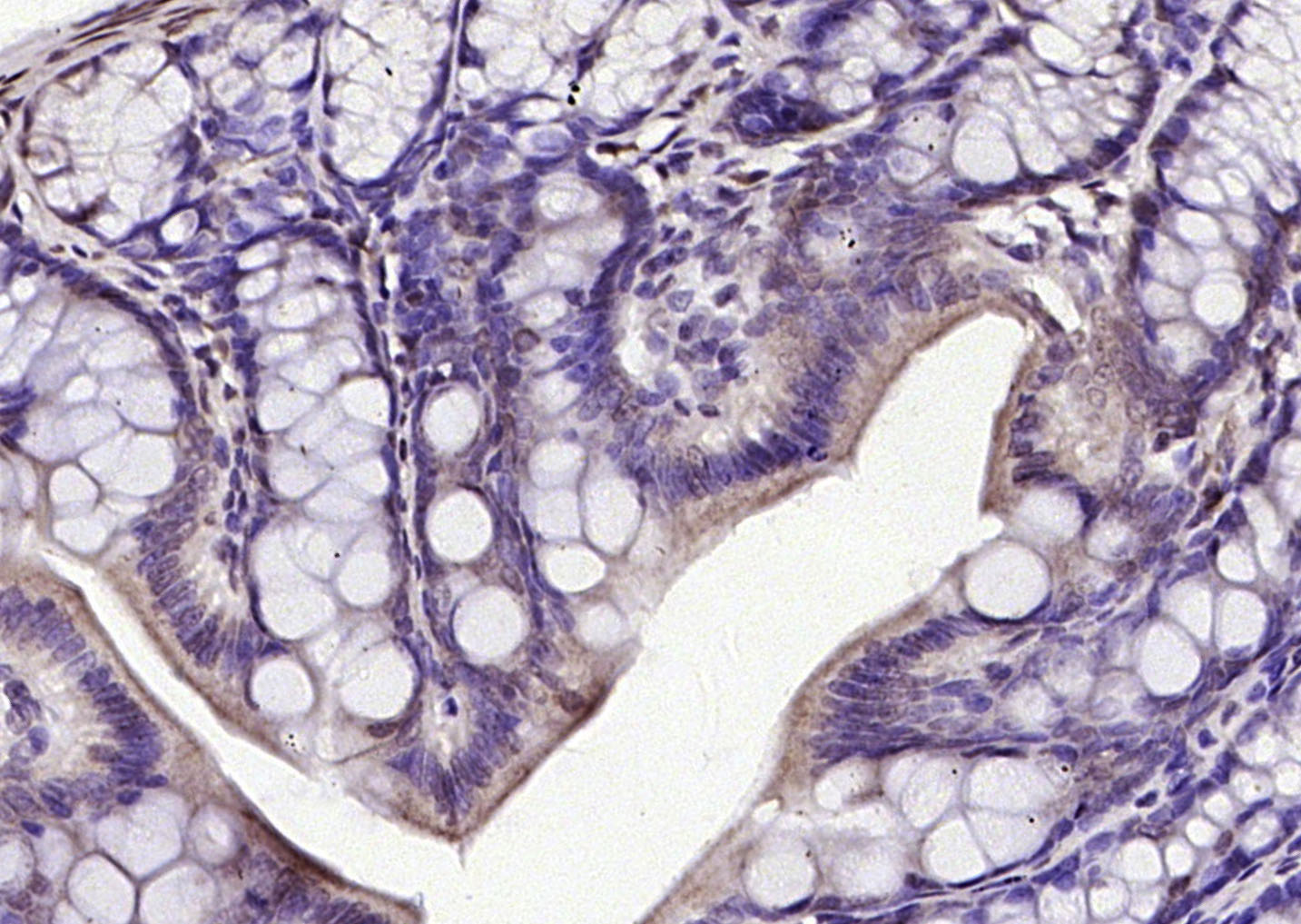 磷酸化转录因子E2F-1抗体-bs-4076R