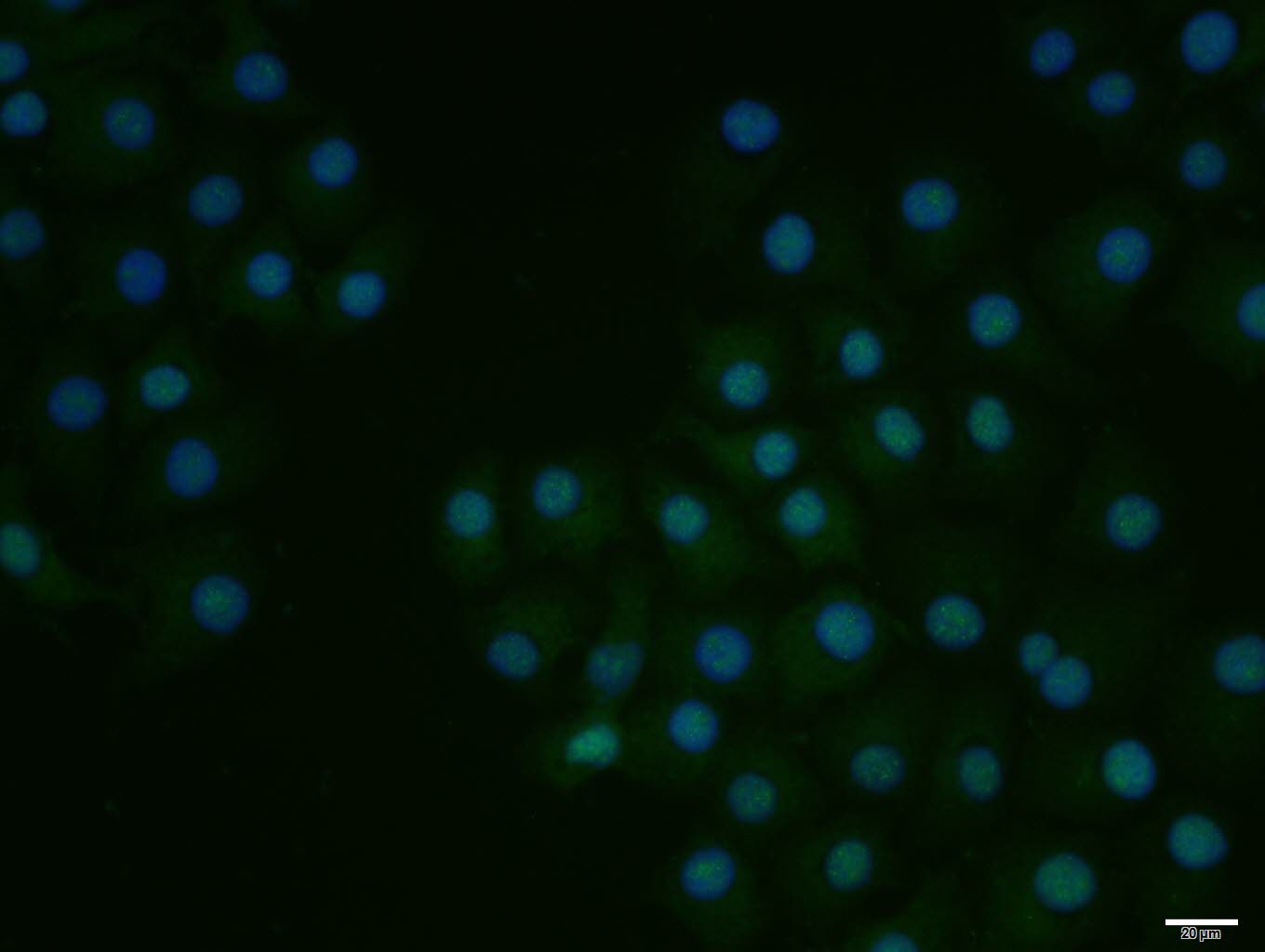 磷酸化转录因子E2F-1抗体-bs-4076R