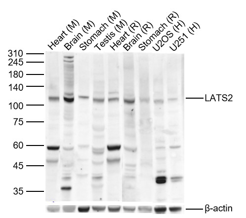 LATS2 Rabbit pAb (一抗) | Bioss