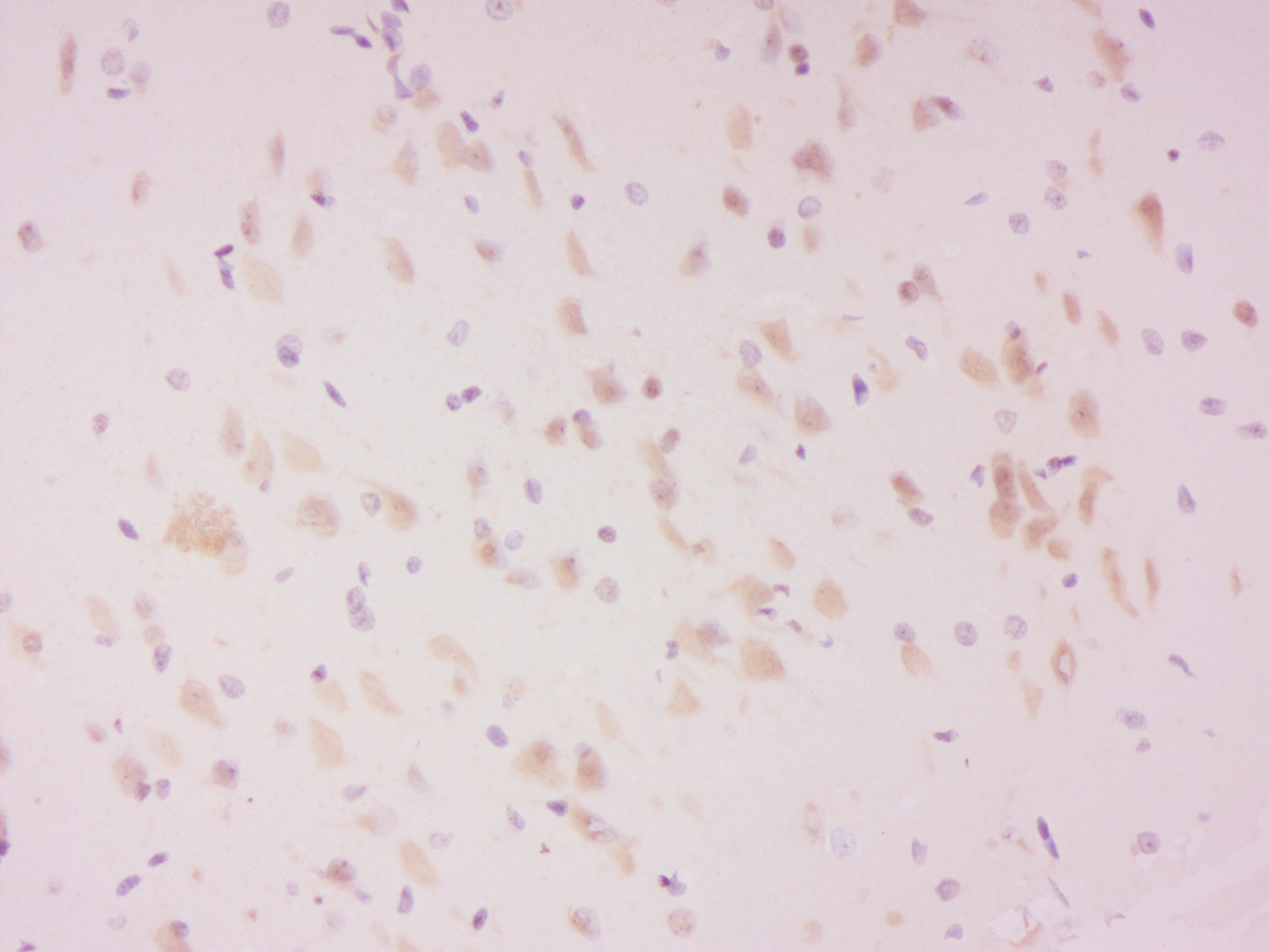 phospho-LATS2 (Ser83) Rabbit pAb (一抗) - IHC-P,IHC-F,IF | Bioss