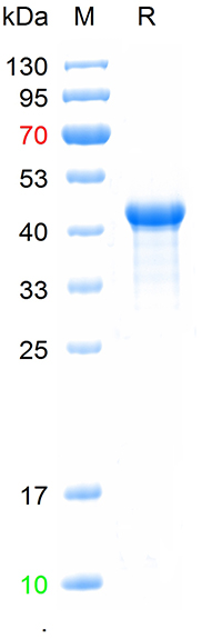 Recombinded human Cyclin D1 protein, N-His (重组蛋白) | Bioss