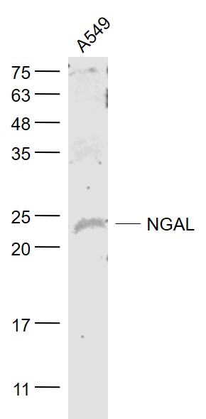 NGAL/Lipocalin 2 Rabbit pAb (一抗) | Bioss