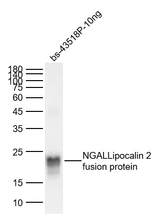 脂质运载蛋白抗体-bs-41133R