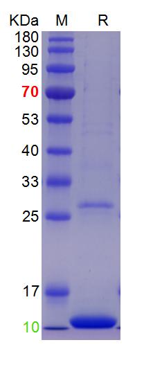 Recombinant human Beta-2-microglobulin, C-His (重组蛋白) | Bioss