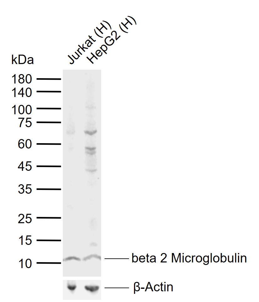 beta 2 Microglobulin Rabbit pAb (一抗) | Bioss