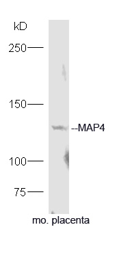 MAP4 Rabbit pAb (一抗) | Bioss