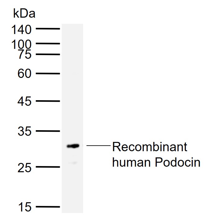 NPHS2 Rabbit pAb (一抗) | Bioss