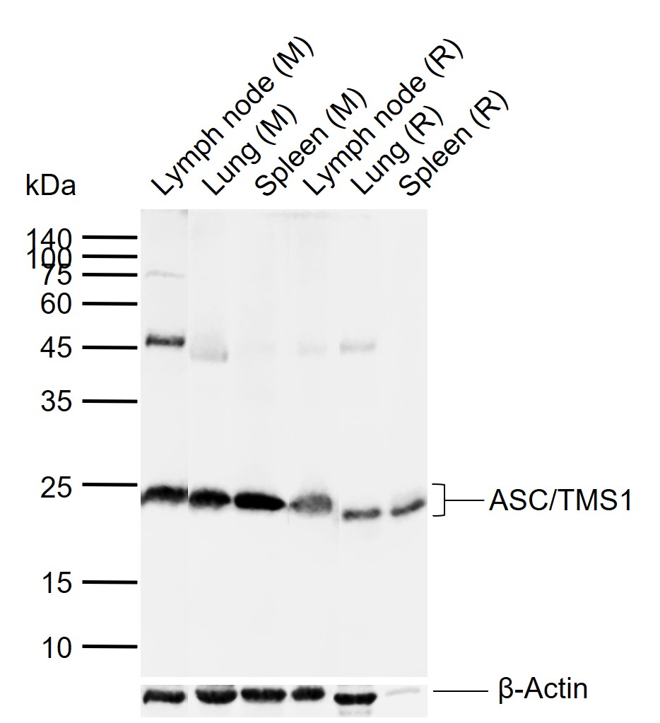 ASC/TMS1 Rabbit pAb (一抗) | Bioss