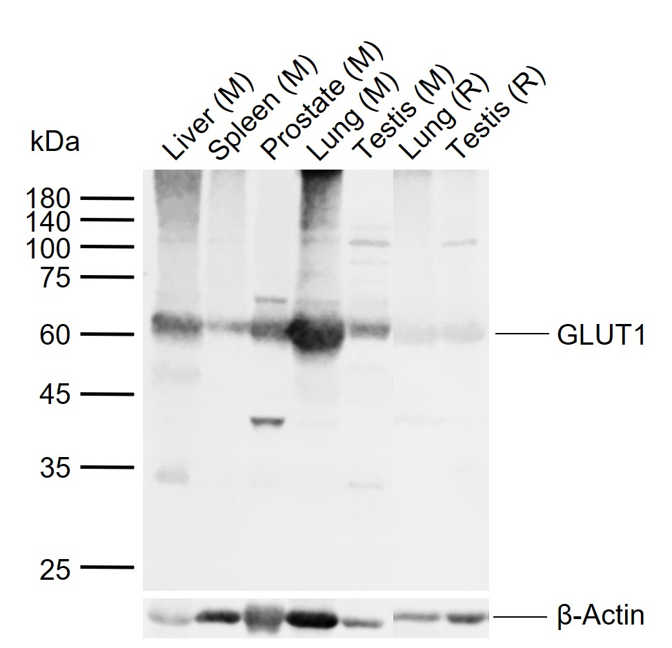 GLUT1 Rabbit pAb (一抗) | Bioss