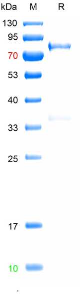 重组非洲猪瘟p72蛋白