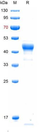 重组猪乙脑病毒(JEV)NS1蛋白