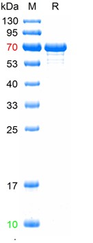 重组猪细小病毒VP2蛋白