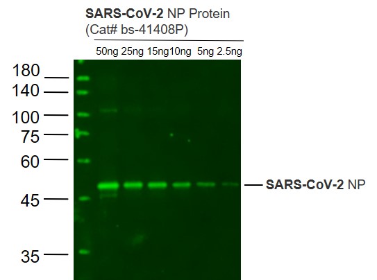 SARS-CoV-2 N protein