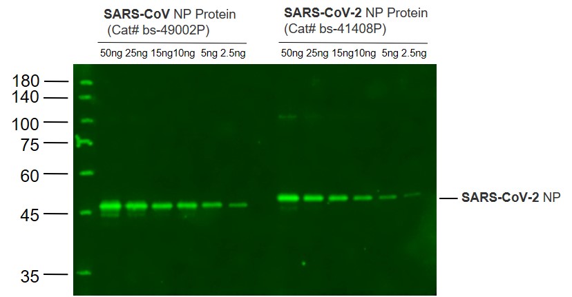 SARS-CoV-2 N protein