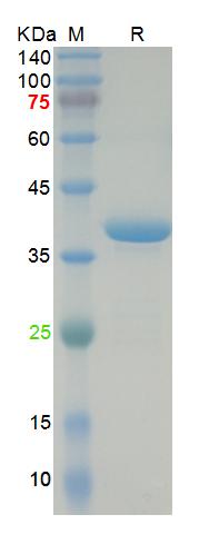 Recombinant SARS-Cov-2 N protein, DsbC & His