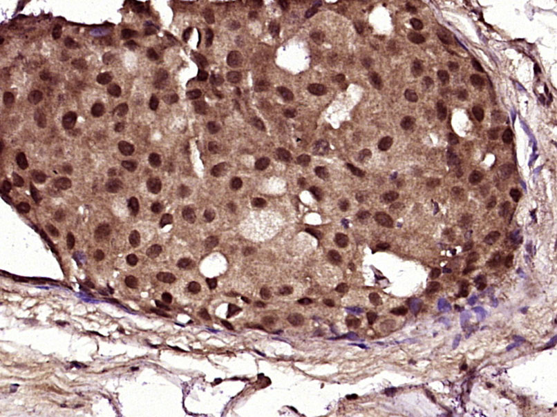 NF1 Rabbit pAb (一抗) | Bioss