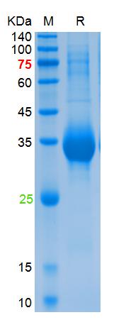 Recombinant SARS-Cov-2 Spike RBD protein (E417N, E484K, N501Y), His