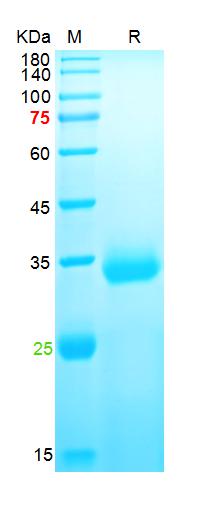 Recombinant SARS-Cov-2 Spike RBD protein (Y453F), His