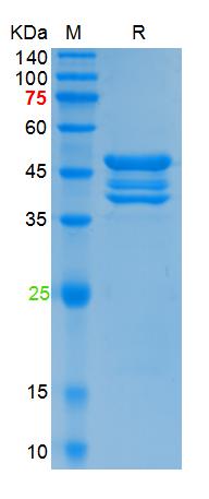 Recombinant SARS-Cov-2 N protein (Q9H, P67S, P80R, P151L, S183Y), His